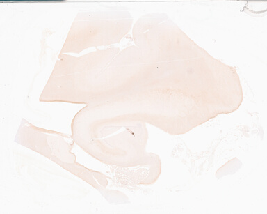 ['deident_f4d26da2-e999-4365-8f7c-e71fe0b25c83_69d95008.jpg']