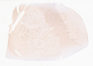 ['deident_08a5d2fe-67b6-4d98-80a8-bda2c1745046_69d94f8b.jpg']