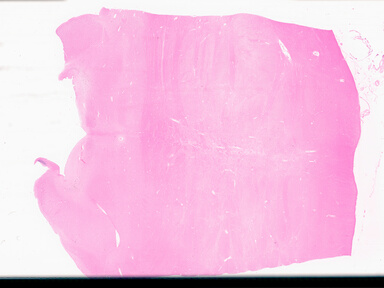 ['deident_3ef02797-908f-4a39-ae14-3bcb1590cd99_69d94fa3.jpg']