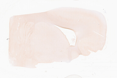 ['deident_9a11c641-4151-416b-a8b0-c05246bc0901_69d94fd8.jpg']