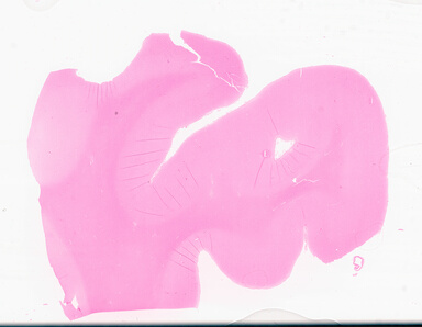 ['deident_eb9cd132-6247-4804-93ba-8eac797120da_69d95002.jpg']
