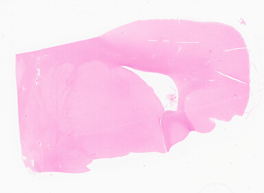 ['deident_2c6a1622-a631-433e-a715-dee72f8c7b1e_69d94f9a.jpg']