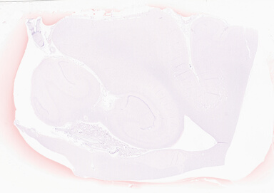 ['deident_beb01ecd-fb83-462d-aefd-7dde757fe807_69d94fe5.jpg']