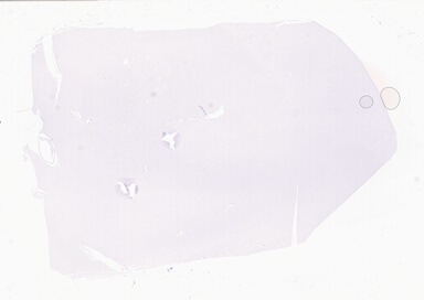 ['deident_65a454b7-0630-4067-9e61-4d70c745b12b_69d94fb4.jpg']