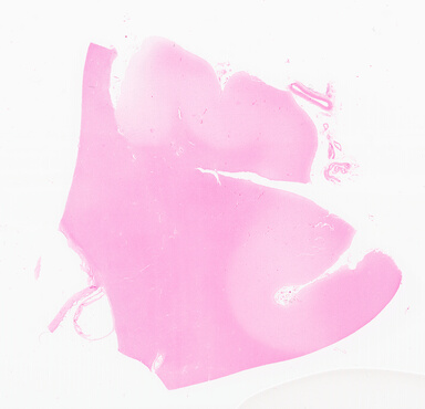 ['deident_987cd64b-b1d5-44b8-96fc-5e74c40bc016_69d94fd6.jpg']