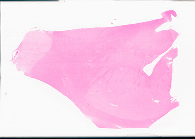 ['deident_8ae24bf7-9104-4bb6-a91d-2a143e71cb2f_69d94fcf.jpg']