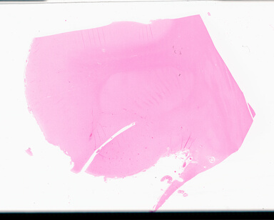 ['deident_80de1cc5-bd9b-426f-9a29-333ee0aa2409_69d94fca.jpg']