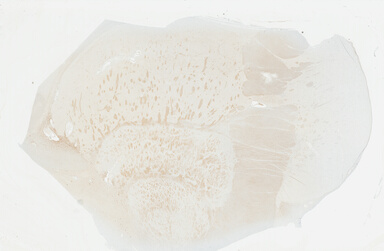 ['deident_6be1b812-5f57-483d-b943-2bafd385df8a_69b049da.jpg']