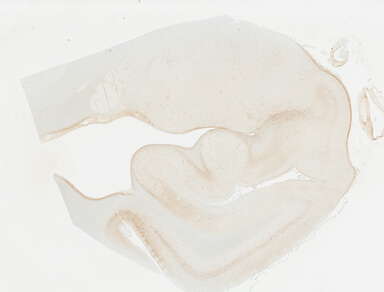 ['deident_26f2ab89-fe1e-4074-8494-b02569424334_69b049cb.jpg']