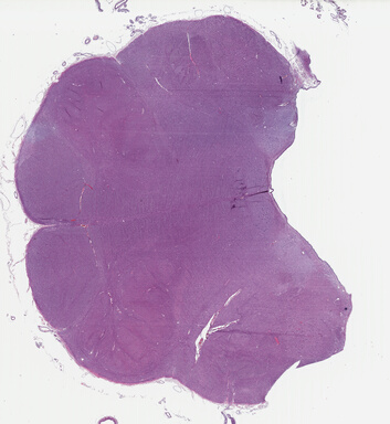 ['deident_badc1c50-877e-41ce-8fcd-a341c7e8c4a5_69b049f8.jpg']
