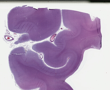 ['deident_40da48a3-2388-4821-89f5-86dd01c68682_69b049cf.jpg']