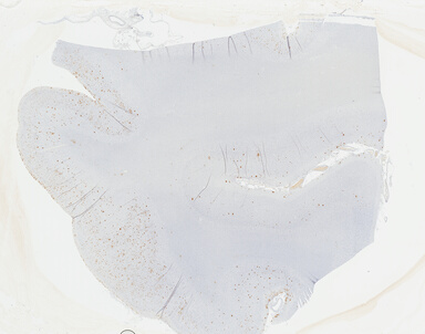 ['deident_f7ff7d1a-0126-48b2-a997-8fd954a6a9f2_69b04a0f.jpg']