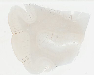 ['deident_95e82754-d1da-46ed-964c-97a1bd78845d_69b049ea.jpg']