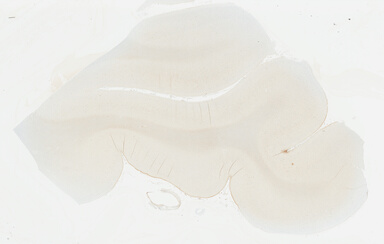 ['deident_627c9063-78ce-4c0f-b82b-590eebb1e1c4_69b049d7.jpg']