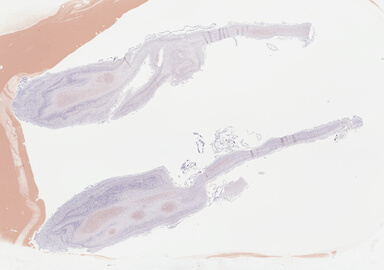 ['deident_ee608d0e-4721-4ee4-9571-bf56ab55ed8b_69b04a08.jpg']
