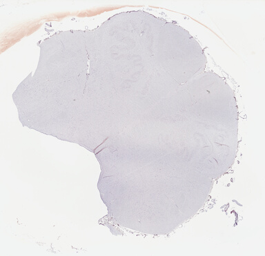 ['deident_f26a489a-953f-4360-aa43-06f1b4d9ad78_69b04a0c.jpg']