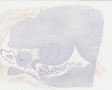 ['deident_194178ea-3763-4c97-939b-b627ecb08200_69b049c7.jpg']