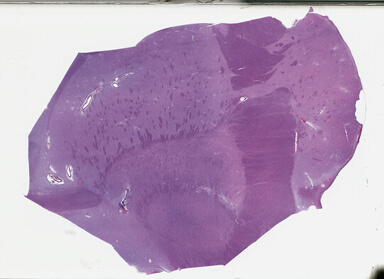 ['deident_b9f2049d-ef71-49de-af74-285789b7c4e2_69b049f4.jpg']
