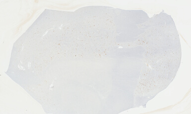 ['deident_08a7d05f-a866-4e93-bee4-243470ee60d5_69b049bd.jpg']