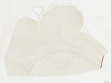 ['deident_7df47994-4d32-4a8c-937e-66745c9664ac_69b049e3.jpg']