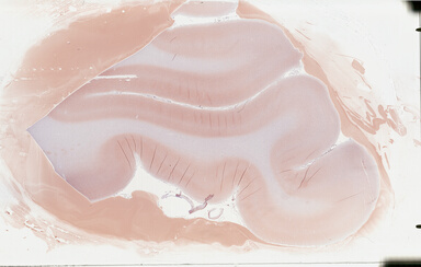['deident_bbc982af-da1d-436f-87a9-7be48556ec1a_69b049fa.jpg']