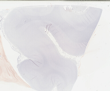 ['deident_fc55770c-f51b-45cf-97e3-bf1ebb56e4d9_69b04a11.jpg']