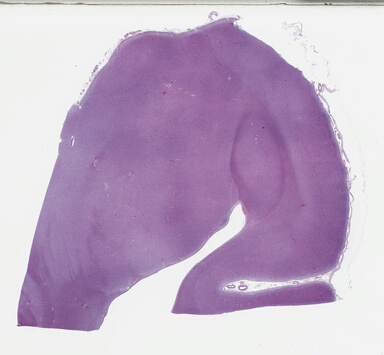 ['deident_d4923b3a-3411-4ecf-8aa9-b74d1a41fe19_69b049ff.jpg']