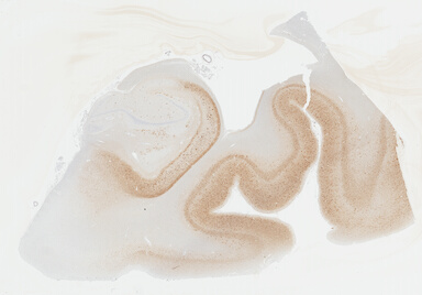 ['deident_0cbb7aec-2868-4d92-b0a1-0a1f22974936_695fd107.jpg']