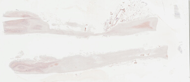 ['deident_1af2644a-c91c-471a-97de-68237b473b77_695fd10e.jpg']