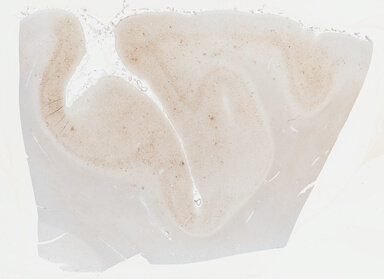 ['deident_f5e957db-cc2a-4312-8a97-2e3332d47f5e_695fd14d.jpg']