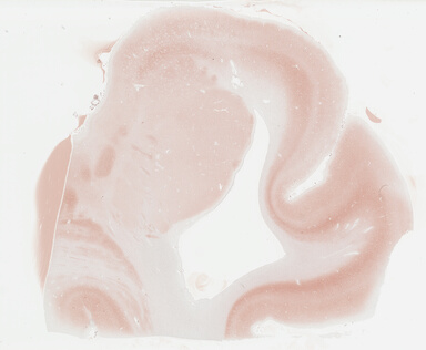 ['deident_c82e5932-1872-443f-9c1f-2fdc7a25deb2_695fd13d.jpg']