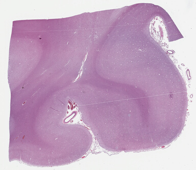 ['deident_5426d5de-d72d-452b-9e6d-8e38296ef300_695fd11b.jpg']