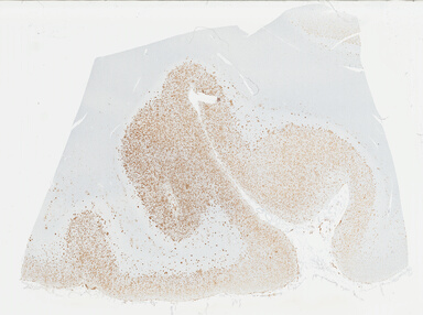 ['deident_121bbd6a-6e6e-41bf-8936-d18f9d9b5031_695fd109.jpg']