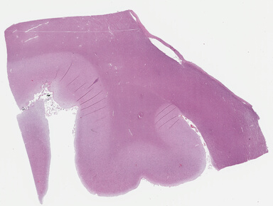 ['deident_e76a4b03-10be-43e2-8c4e-740a176f898e_695fd14a.jpg']