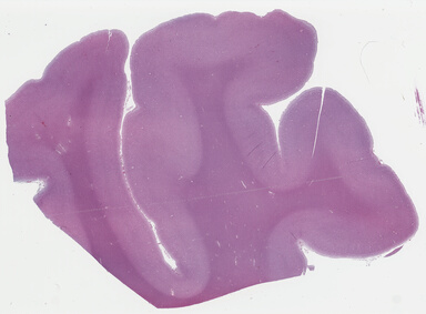 ['deident_791a01e4-d42e-4306-8517-d86211af395d_695fd123.jpg']