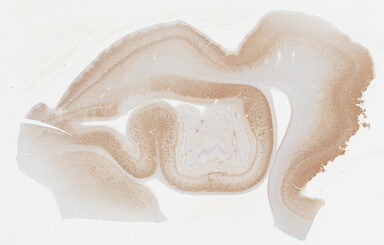 ['deident_af6ca219-1f61-495c-8123-0049ed892a6e_695fd133.jpg']