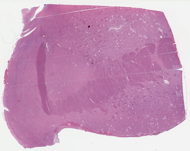 ['deident_e307cf5e-7e8a-477b-add4-d304695675f5_695fd146.jpg']