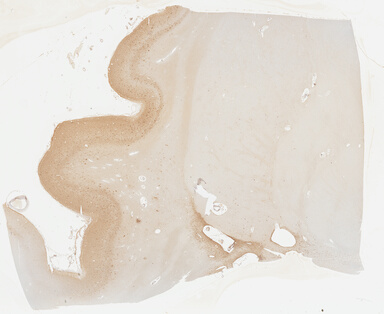 ['deident_01d62ebe-f132-4a73-a84e-02cfe2c4e800_69b0435f.jpg']