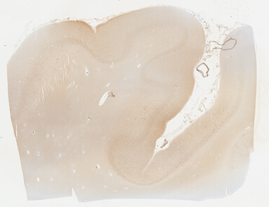 ['deident_492134ff-7159-44d0-9511-fae88c8d46fa_69b04378.jpg']