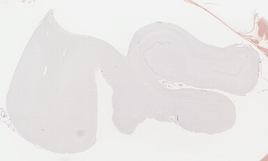 ['deident_9390bef8-aa9f-4082-b5f4-56e0599f991b_69b04390.jpg']