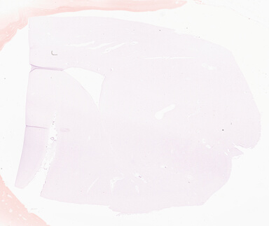 ['deident_3eb5d26a-3b84-4d20-a558-a7abf040331c_69b0436e.jpg']