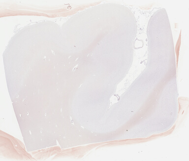 ['deident_16be90dc-7ca9-4725-90d8-5bc8b0cf5682_69b04365.jpg']