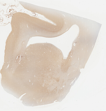 ['deident_fa702eee-1ca9-440f-b9e2-a02cef0fd7f5_69b043ab.jpg']