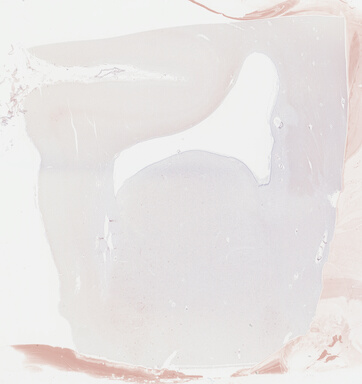 ['deident_ff2dbf5c-ce31-42eb-974b-dc2f0bce8415_69b043ac.jpg']