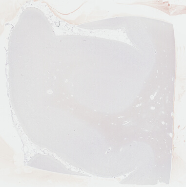 ['deident_be084ef9-21bc-4d51-b993-fb8eb2121e06_69b043a0.jpg']
