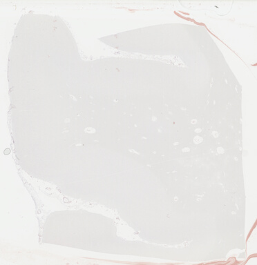 ['deident_8f25a69f-143c-4d9e-b10e-01d06e57f570_69b0438e.jpg']