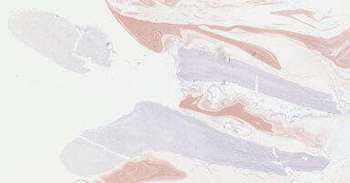 ['deident_0a59265e-a906-4bc3-a7b8-0ccf0f9cc019_69b04360.jpg']