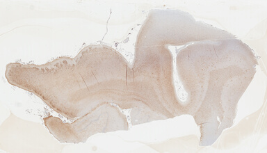 ['deident_404170ca-69cd-4709-b174-a9b44f7bf154_69b04130.jpg']
