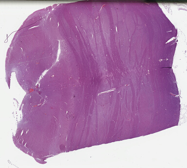 ['deident_7f79f1e6-eed5-4845-8502-504cc2d5fb4e_69b0414e.jpg']