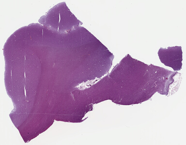 ['deident_24ac8247-47ab-4e01-92b2-9779a4a44bf1_69b0411e.jpg']